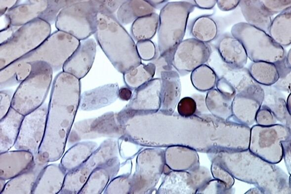 stanice gljivica noktiju pod mikroskopom